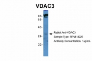 ARP35179_P050 - VDAC-3