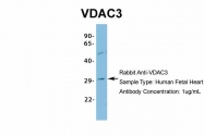ARP35180_P050 - VDAC-3