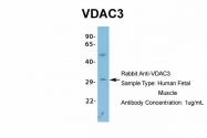 ARP35180_P050 - VDAC-3