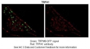 ARP35205_P050 - TRPA1