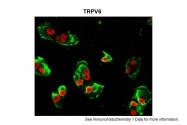 ARP35284_P050 - TRPV6 / ECAC2