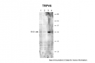 ARP35284_P050 - TRPV6 / ECAC2