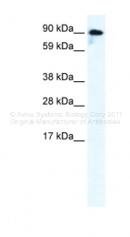ARP35341_P050 - Glutamate receptor 6 / GLUR6