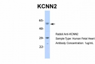 ARP35439_P050 - KCNN2