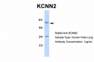 ARP35439_P050 - KCNN2