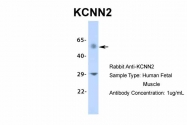 ARP35439_P050 - KCNN2