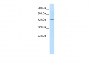 ARP35529_T100 - KCNQ1