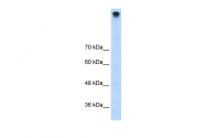 ARP35609_T100 - TRPM3 / Melastatin-2