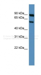 ARP35615_P050 - Serotonin receptor 3A (HTR3A)