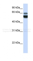 ARP35630_P050 - SMPD1