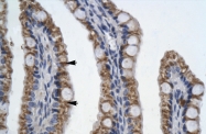 ARP35634_T100 - PITX2