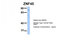 ARP35665_P050 - ZNF45