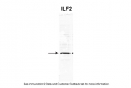 ARP35731_T100 - ILF2