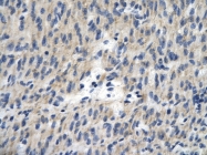ARP35748_P050 - TCEAL1 / SIIR