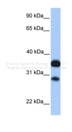 ARP35789_P050 - CITED2