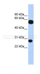 ARP35801_P050 - TRIM16
