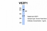ARP35830_P050 - VEZF1