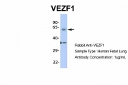 ARP35830_P050 - VEZF1