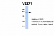 ARP35830_P050 - VEZF1