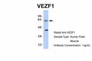 ARP35830_P050 - VEZF1