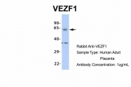 ARP35830_P050 - VEZF1