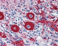 ARP35830_P050 - VEZF1