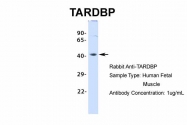 ARP35837_P050 - TARDBP