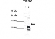 ARP35838_P050 - TARDBP