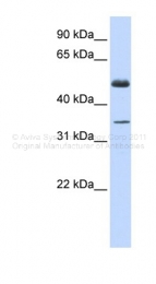ARP35868_P050 - ZNF223