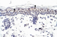 ARP35869_P050 - ZNF223