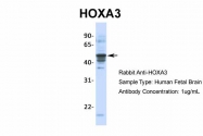 ARP36056_T100 - HOXA3 / HOX1E