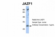 ARP36246_P050 - JAZF1 / ZNF802
