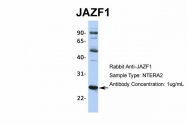 ARP36246_P050 - JAZF1 / ZNF802