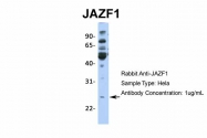 ARP36246_P050 - JAZF1 / ZNF802