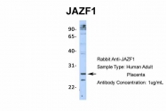 ARP36246_P050 - JAZF1 / ZNF802