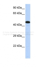 ARP36322_P050 - AKAP5