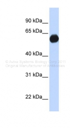 ARP36334_P050 - AKAP1