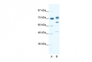 ARP36374_P050 - DDX21