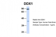 ARP36379_P050 - DDX1