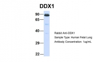 ARP36379_P050 - DDX1