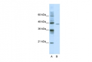 ARP36410_P050 - DDX25