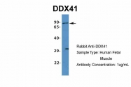 ARP36437_P050 - DDX41