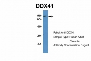 ARP36437_P050 - DDX41