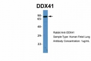 ARP36437_P050 - DDX41