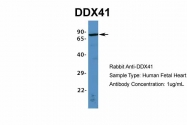 ARP36437_P050 - DDX41