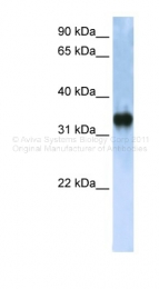 ARP36443_P050 - ZCCHC17