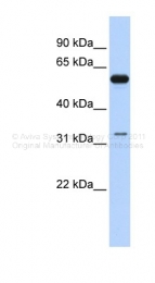 ARP36457_P050 - DDX28