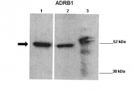 ARP36551_P050 - Beta-1 adrenergic receptor
