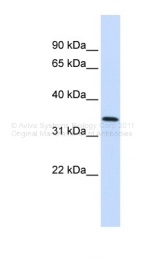 ARP36570_P050 - Annexin A4 / ANXA4