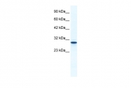 ARP36573_T100 - Annexin A5 / ANXA5
